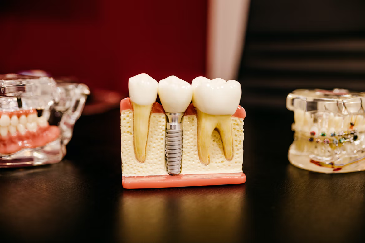 Dental Checkup on a Regular Basis